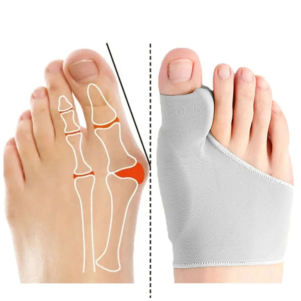 Instant Bunion Pain Relief